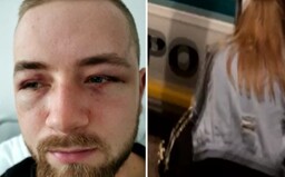 Slováka Jakuba vraj policajná hliadka dobila tak, že mu zlomili časť lebky. V cele mu kľačali na krku a bál sa, že zomrie