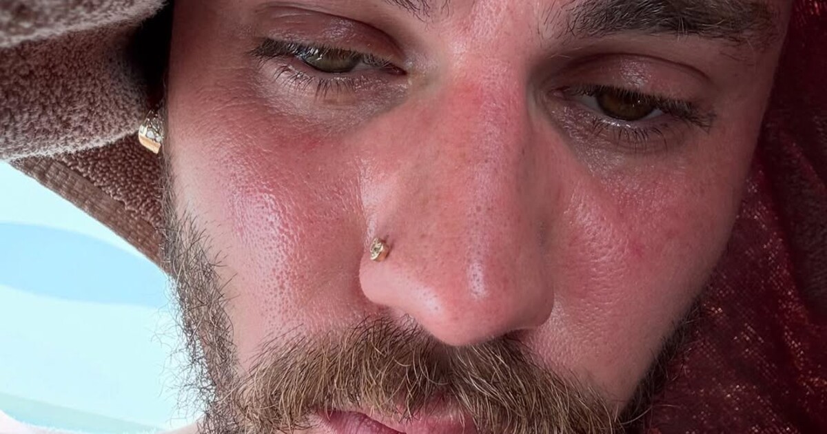 Justin Bieber zveřejnil fotky z „detoxu“. Tisíce lidí mu vyjádřily podporu