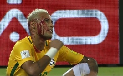 Stal se historicky čtvrtým nejlepším brazilským střelcem, ale skončil i celý zakrvácený. Neymar tentokrát nic nepředstíral, ale žlutá karta pro soupeře i tak nepřišla Stal se historicky čtvrtým nejlepším brazilským střelcem, ale skončil i celý zakrvácený. Neymar tentokrát nic nepředstíral, ale žlutá karta pro soupeře i tak nepřišla