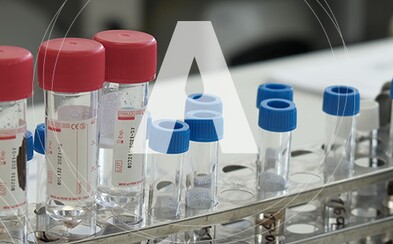 Súkromné slovenské laboratórium Alpha medical má skoro 2000 profesionálnych testov, ďalšie priebežne dopĺňa. Ponúka ich štátu Súkromné slovenské laboratórium Alpha medical má skoro 2000 profesionálnych testov, ďalšie priebežne dopĺňa. Ponúka ich štátu