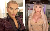 Svetoznámy Ken sa postupne mení na Barbie. Za zadok ako má Kim Kardashian najnovšie zaplatil 33-tisíc eur 