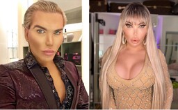 Svetoznámy Ken sa postupne mení na Barbie. Za zadok ako má Kim Kardashian najnovšie zaplatil 33-tisíc eur