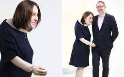 Takto budeme podle odborníků vypadat za 20 let. Velký hrb, křečové žíly, oteklé končetiny a ekzém