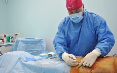 Takto vypadá liposukce: Byli jsme přímo na sále. Vyplatí se ti nechat si odsát tuk? Takto vypadá liposukce: Byli jsme přímo na sále. Vyplatí se ti nechat si odsát tuk?
