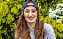Úradujúca Superstar Barbora Piešová siahla po výraznej zmene imidžu. Zbavila sa charakteristického strojčeka na zuboch