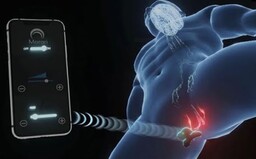 Už aj na oddialenie ejakulácie je smart zariadenie. Bluetooth náplasť ukázali na CES 2021