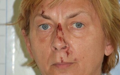 V Chorvatsku našli zraněnou žena, která neví, jak se jmenuje a kde se tam vzala