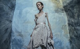 V desiatich rokoch prestala jesť. Aj napriek 23 rokom s anorexiou očarila svet svojimi fotografiami
