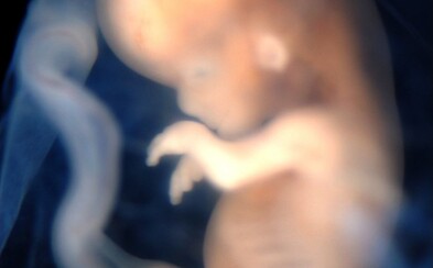 Vedci vytvorili prvý hybrid človeka a opice. Experiment musel kvôli rizikám prebehnúť v Číne Vedci vytvorili prvý hybrid človeka a opice. Experiment musel kvôli rizikám prebehnúť v Číne