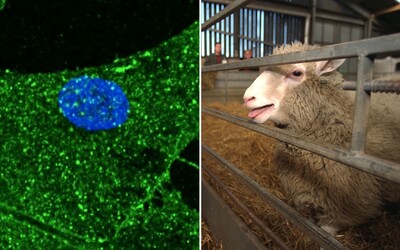 Vědcům se podařilo omladit buňky kůže o 30 let. Použili metodu, pomocí níž v 90. letech naklonovali ovci Dolly