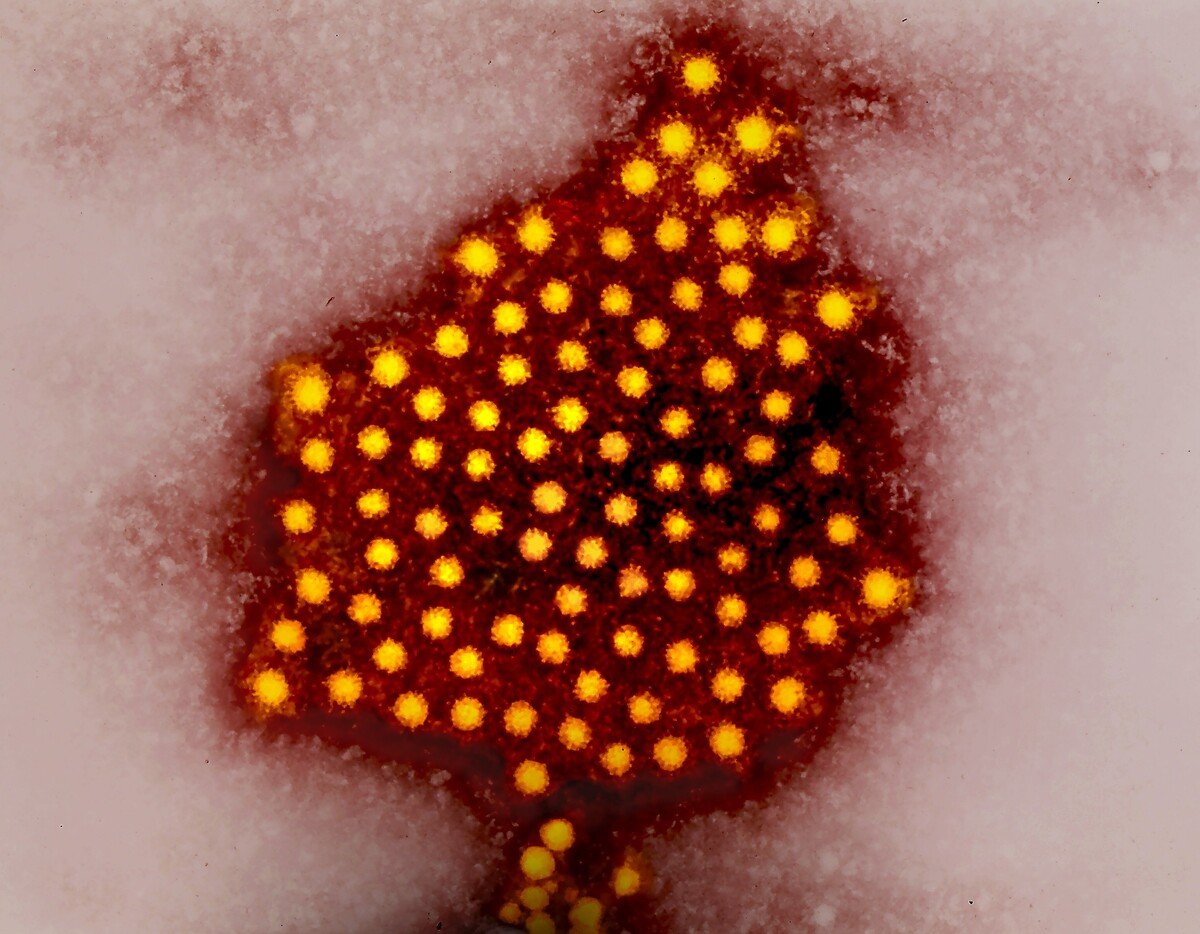 hepatitida a