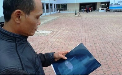 Vietnamec mal v bruchu celých 18 rokov zabudnuté nožnice. Žil bežným životom a až nedávno sa začal sťažovať na bolesti Vietnamec mal v bruchu celých 18 rokov zabudnuté nožnice. Žil bežným životom a až nedávno sa začal sťažovať na bolesti