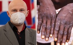 Virológ Boris Klempa: Na prenos opičích kiahní treba úzky kontakt. Nejde však len o pohlavný styk (Rozhovor)