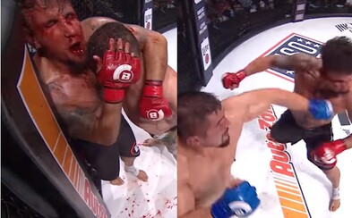 Vylámané zuby si chtěl vytáhnout z úst a bít se dál. MMA bojovník ztratil chránič a skončil celý od krve Vylámané zuby si chtěl vytáhnout z úst a bít se dál. MMA bojovník ztratil chránič a skončil celý od krve