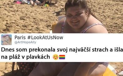 Vysmievali sa a nadávali jej, ale ona prekonala strach a šla v plavkách na pláž. Mladá Paris má zdravotné problémy, ale odmieta im podľahnúť Vysmievali sa a nadávali jej, ale ona prekonala strach a šla v plavkách na pláž. Mladá Paris má zdravotné problémy, ale odmieta im podľahnúť