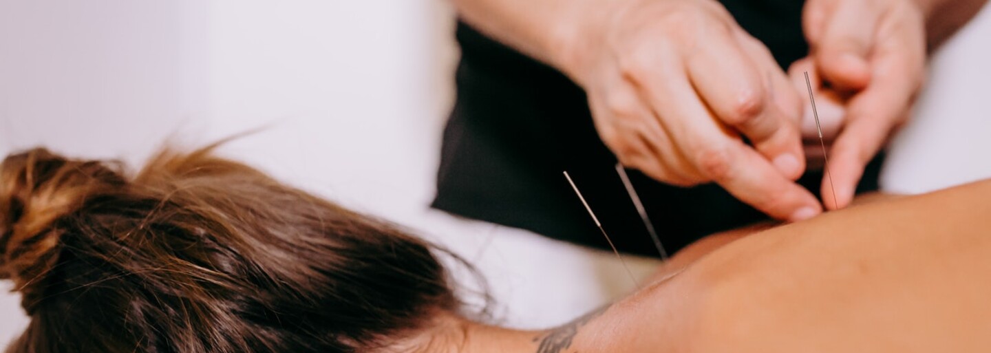 We've Tried Acupuncture. Here's a Report on How It Went, Whether It's Painful and How Much It Generally Costs.