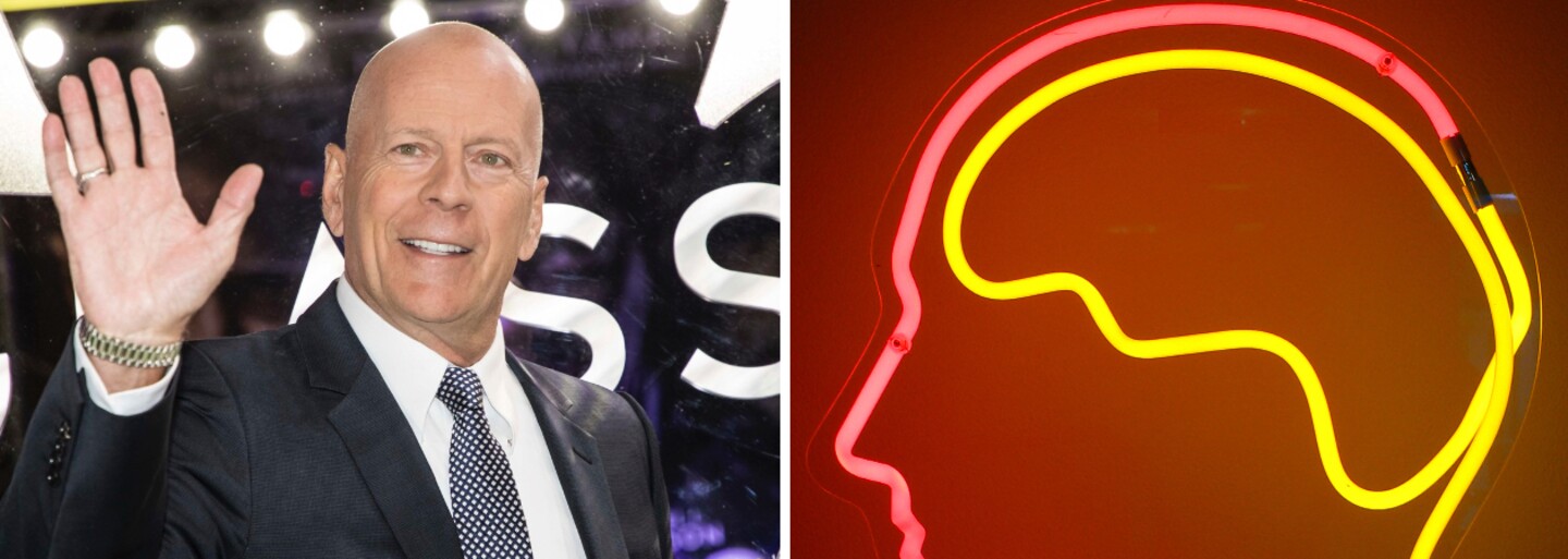 What Ended Bruce Willis's Career? Aphasia Is a Speech Loss Condition Which, According to Experts, Will Only Get Worse