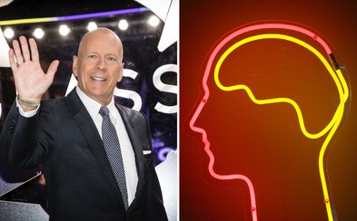 What Ended Bruce Willis's Career? Aphasia Is a Speech Loss Condition Which, According to Experts, Will Only Get Worse