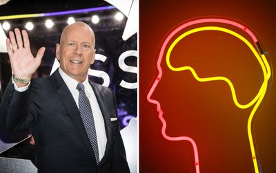 What Ended Bruce Willis's Career? Aphasia Is a Speech Loss Condition Which, According to Experts, Will Only Get Worse