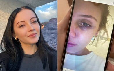 Young women told us about toxic relationships: He used to have unpredictable tantrums, I believed it was my fault Young women told us about toxic relationships: He used to have unpredictable tantrums, I believed it was my fault