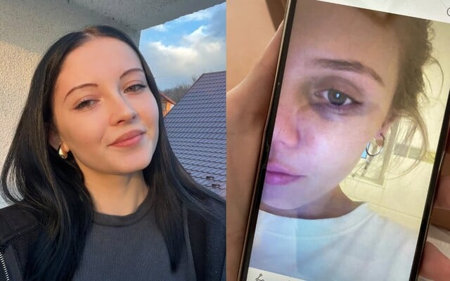 Young women told us about toxic relationships: He used to have unpredictable tantrums, I believed it was my fault Young women told us about toxic relationships: He used to have unpredictable tantrums, I believed it was my fault