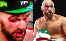 Zakrvavený Tyson Fury si odnáša ďalšiu cennú výhru. Zdolal doteraz neporazeného Wallina