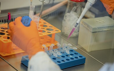 Záznam: Na Slovensku je jedenásť nových prípadov. Celkovo sa koronavírusom nakazilo už 32 Slovákov Záznam: Na Slovensku je jedenásť nových prípadov. Celkovo sa koronavírusom nakazilo už 32 Slovákov