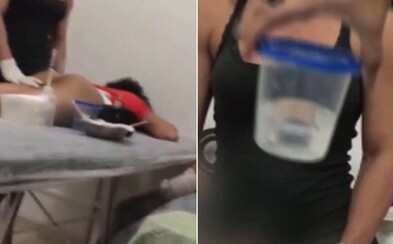 Ženy si v Brazílii nechávajú upravovať zadky do dokonalosti látkou, ktorá ich môže aj zabiť. Kvôli vysnívanému telu obetujú vlastné zdravie Ženy si v Brazílii nechávajú upravovať zadky do dokonalosti látkou, ktorá ich môže aj zabiť. Kvôli vysnívanému telu obetujú vlastné zdravie