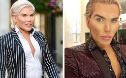 Živý Ken se chystá na šílenou operaci. Vyjmou mu 6 žeber, aby se z něj stala Barbie