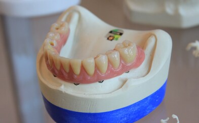 Zubař vytáhl pacientovi skoro 4 centimetry dlouhý zub. Zapsal se do Guinnessovy knihy rekordů Zubař vytáhl pacientovi skoro 4 centimetry dlouhý zub. Zapsal se do Guinnessovy knihy rekordů
